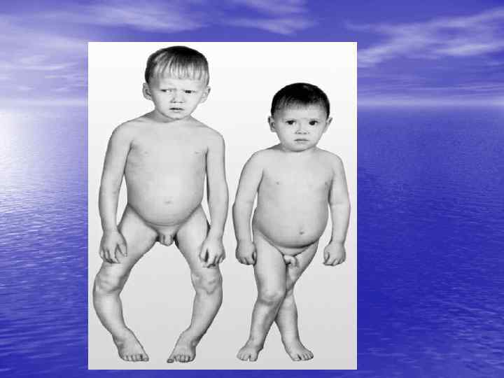 диспансерное наблюдение за детьми с хроническими расстройствами питания