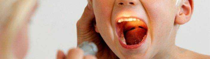 питание при фолликулярной ангине у детей