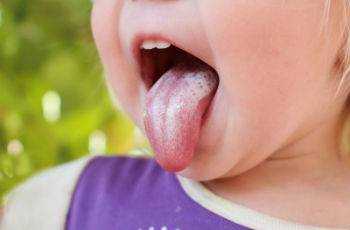 питание при молочнице во рту у детей